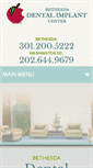 Mobile Screenshot of bethesdadentalimplantcenter.com